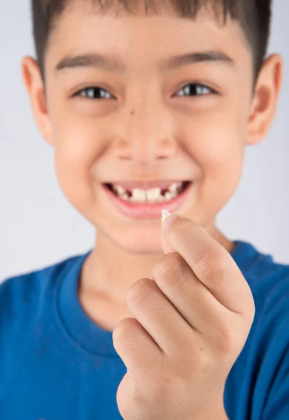 Menino mostrando dentes de bebê sem dentes perto esperando por novos dentes — Fotografia de Stock