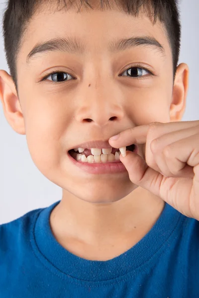 小男孩显示乳牙牙关闭等待新的牙齿 — 图库照片