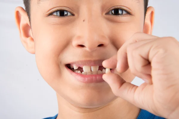 Pequeño niño mostrando dientes de bebé sin dientes de cerca esperando nuevos dientes —  Fotos de Stock