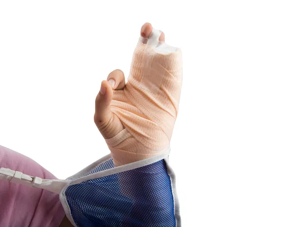 Mulher mão osso quebrado makehand sinal ok — Fotografia de Stock