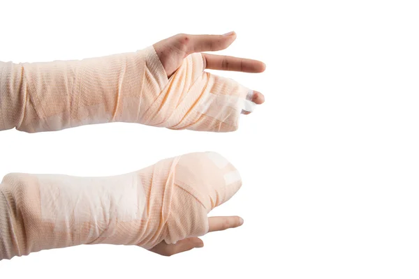 Vrouw hand bot gebroken van ongeval nood — Stockfoto