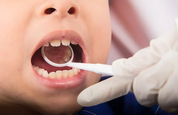 Menino irmão fingir como um dentista fechar dentro da boca check-up — Fotografia de Stock