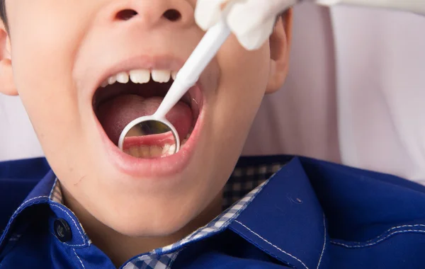 Little sibling boy pretend as a dentist close up inside mouth check up — Stock Photo, Image