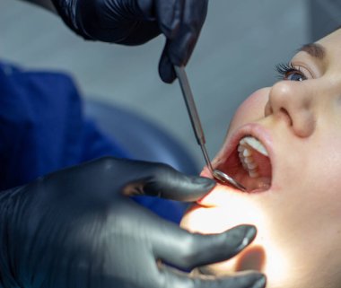 Dişlerinde diş teli olan bir kadın diş hekimi koltuğunda bir dişçiyi ziyaret ediyor. Üst ve alt dişlere tel kemeri yerleştirme işlemi sırasında. Doktor dişleri inceler. dişçilik