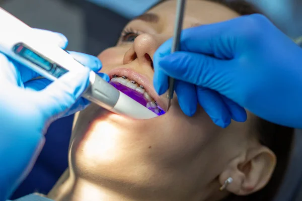 Diş teli takan bir kadın klinikteki bir ortodontiste gidiyor. Üst ve alt dişlere diş teli taktırma işlemi sırasında dişçi koltuğunda. Dişçi ve asistan birlikte çalışıyor, ellerinde diş aletleri var. konsept 