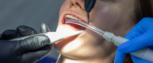 Diş teli takan bir kadın klinikteki bir ortodontiste gidiyor. Üst ve alt dişlere diş teli taktırma işlemi sırasında dişçi koltuğunda. Dişçi ve asistan birlikte çalışıyor, ellerinde diş aletleri var. konsept 