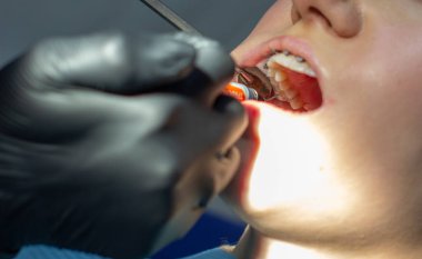 Kemerleri diş telleriyle değiştirmek için dişçi randevusu alan bir kadın..