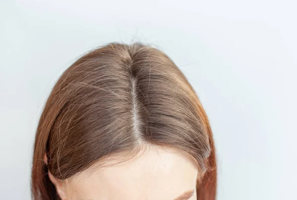 Uma cabeça de mulher com uma separação de cabelo grisalho. — Fotografia de Stock