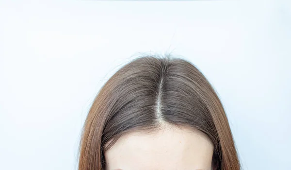 Cabeça Uma Mulher Com Uma Separação Cabelos Grisalhos Que Cresceu — Fotografia de Stock