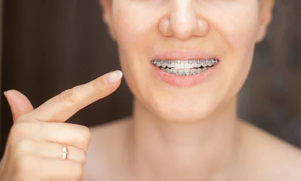 Flickan Pekar Finger Jämna Och Vita Tänderna Med Hängslen Rätta — Stockfoto