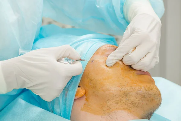 Doctor makes anesthesia to man before cosmetic surgery — Stock Photo, Image