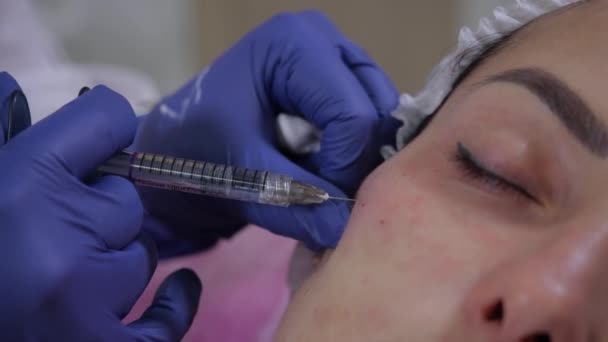 Beautician injecteert jonge vrouw met hyaluronzuur — Stockvideo