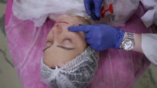 Den kosmetolog i handskarna gör en korrigering av nasolabiala veck — Stockvideo