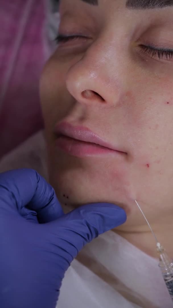A kozmetikus csinál egy eljárást, hogy megfiatalítsa az arcát egy lány beteg töltelék — Stock videók