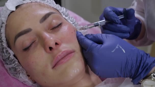 Procedura cosmetica mediante iniezioni di filler a base di acido ialuronico — Video Stock