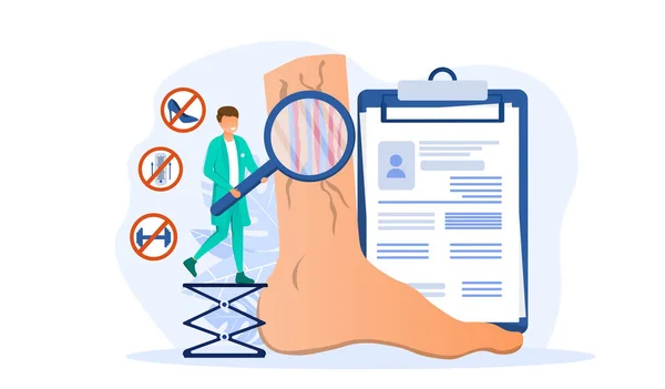 Trombose da veia e tratamento varicoso —  Vetores de Stock