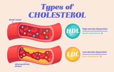 HDL ve LDL ile kolesterol karşılaştırması türleri
