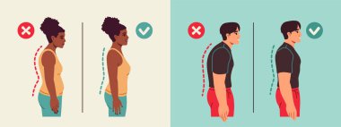 Duruşu yanlış olan bir grup insan. Kamburu çıkmış, omuzları yuvarlak, göbeği dışarı çıkmış, sırtı düz, duruşu ve omuzları düzgün bir kadın ve erkek. Düz vektör illüstrasyonu