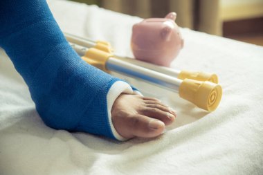 Adamın bacağı ameliyat sonrası yürümek için koltuk değneği kullanıyor. Kırık kemikler ve domuz kumbarası..