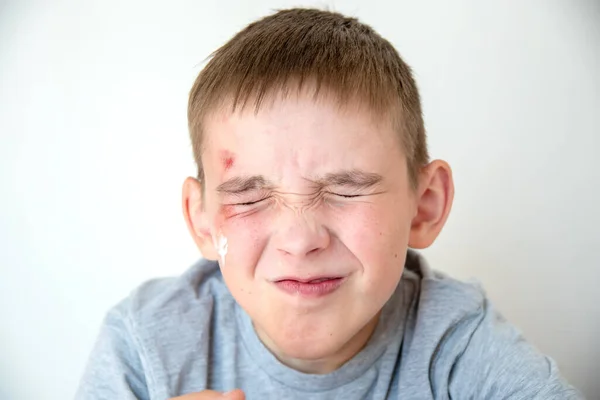 Dor Causada Por Uma Abrasão Rosto Rapaz Rosto Enrugado Criança — Fotografia de Stock