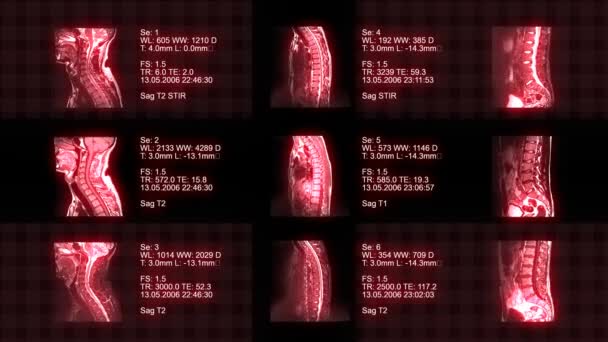 Tomografía animada de columna vertebral — Vídeo de stock