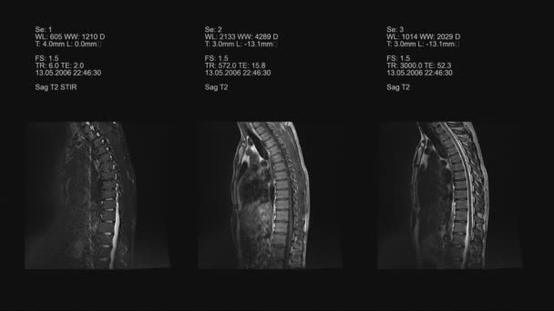 Tomography, Imaging of Spine — Stock Video
