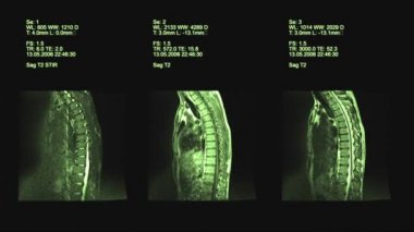 Tomografi, omurga görüntüleme