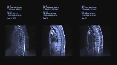Tomografi, omurga görüntüleme