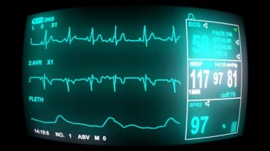 4 k EKG monitör ekran