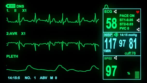 4k ECG monitor screen — Stock Video