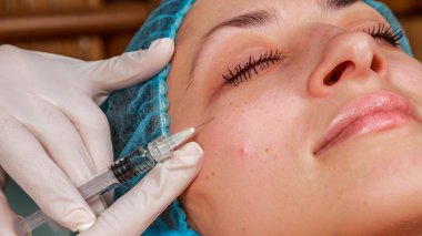 Kozmetik enjeksiyon spa salonda. Güzellik uzmanı hastanın yüz içine enjeksiyon yapar.
