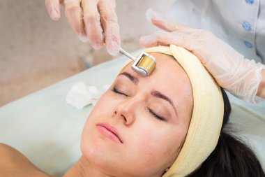 Şevval Özçelik Güzellik Dermaroller yordam gerçekleştirir