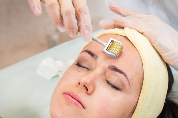 Beautician performs Dermaroller procedure — Stock Photo, Image