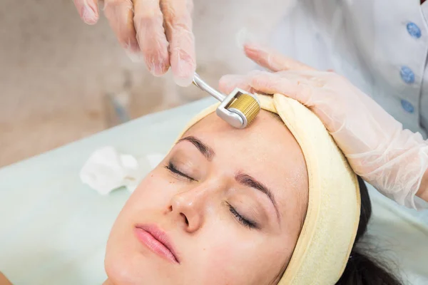 Beautician performs Dermaroller procedure — Stock Photo, Image