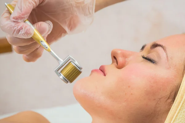 Beautician performs Dermaroller procedure — Stock Photo, Image