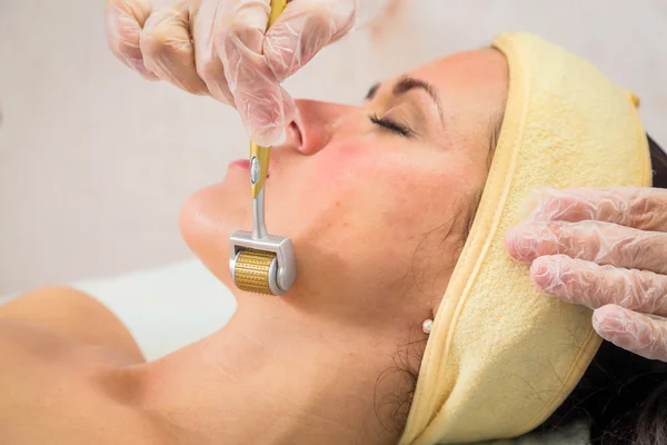 Beautician performs Dermaroller procedure — Stock Photo, Image