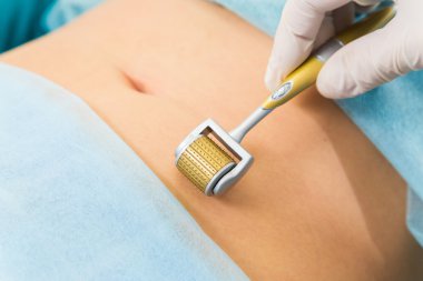 Beautican Demaroller yordam gerçekleştirir