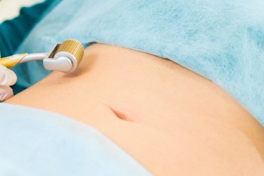 Beautican Demaroller yordam gerçekleştirir