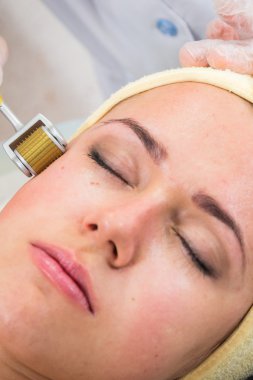 Şevval Özçelik Güzellik Dermaroller yordam gerçekleştirir