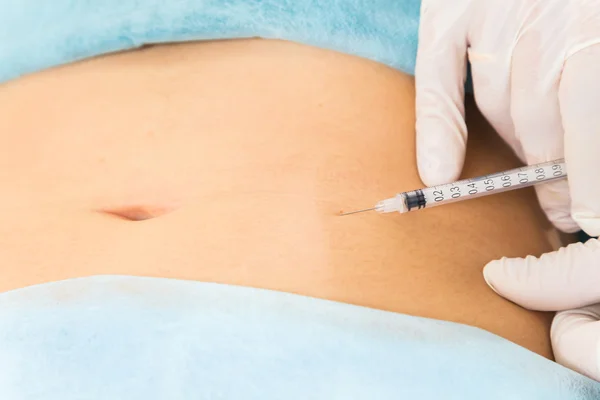 Injection mesotherapy on belly — Stock Photo, Image