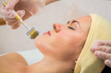 Şevval Özçelik Güzellik Dermaroller yordam gerçekleştirir