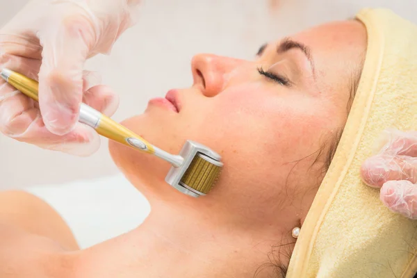 Kosmetolog utför Dermaroller förfarande — Stockfoto