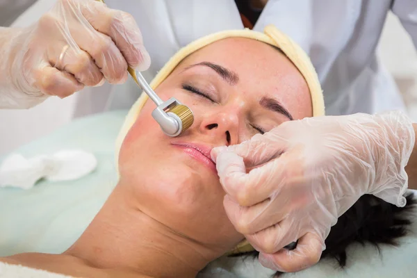 Şevval Özçelik Güzellik Dermaroller yordam gerçekleştirir