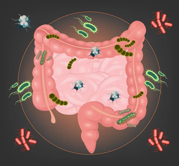 Intestini vettoriali con germi e batteri illustrazione — Vettoriale Stock