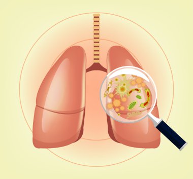 Mikrop ve bakteri ve Büyüteç ile akciğerler. Vektör çizim