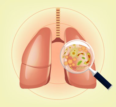 Lungs with germs and bacteria and magnifier. Vector illustration clipart