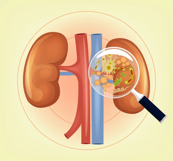 Nieren mit Keimen und Bakterien und Lupe. Vektorillustration — Stockvektor