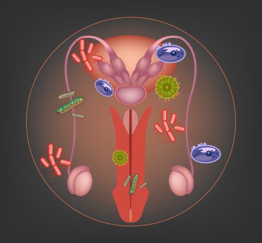 Erkek hasta üreme sistemi. Vektör çizim