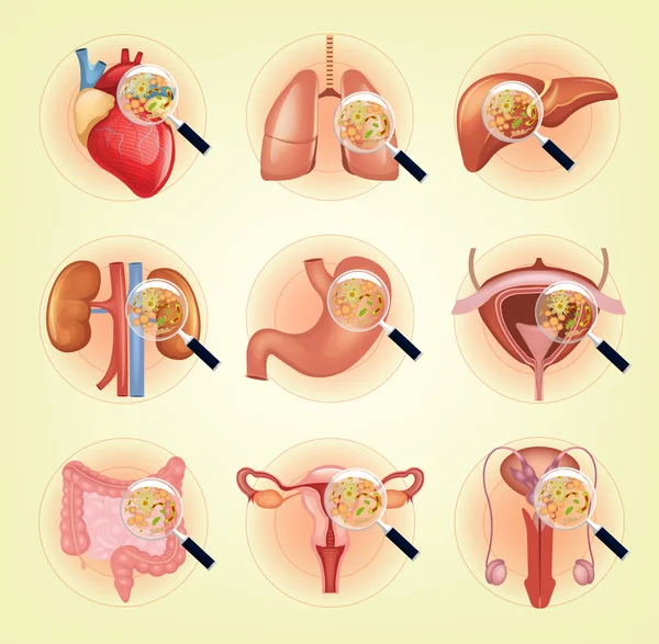 Vector ziek inwendige organen set — Stockvector