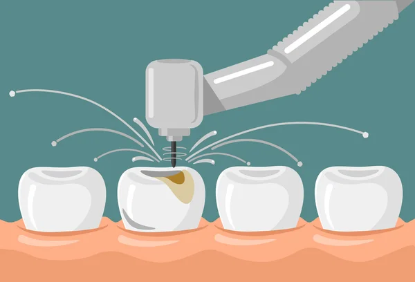 Οδοντιατρική επίπεδη εικόνα διάνυσμα — Διανυσματικό Αρχείο
